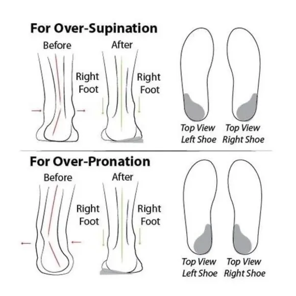 NWOB ORTHOTURE Arch Support &amp; Breathable and Light &amp; Non-Slip Shoes Black 14
